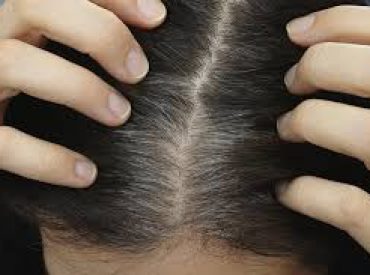 Hallo! Nicht jede Frau hat dichte und dicke Haare. Es gibt Personen, deren Haare stark ausfallen. Wenn du ebenfalls solche Probleme hast, solltest du wissen, warum die Haare eigentlich ausfallen. Lerne Ursachen und Methoden gegen Haarausfall kennen! Warum fallen die Haare aus? Für den Haarausfall sind meistens Gene verantwortlich – dieser Prozess ist mit dem […]