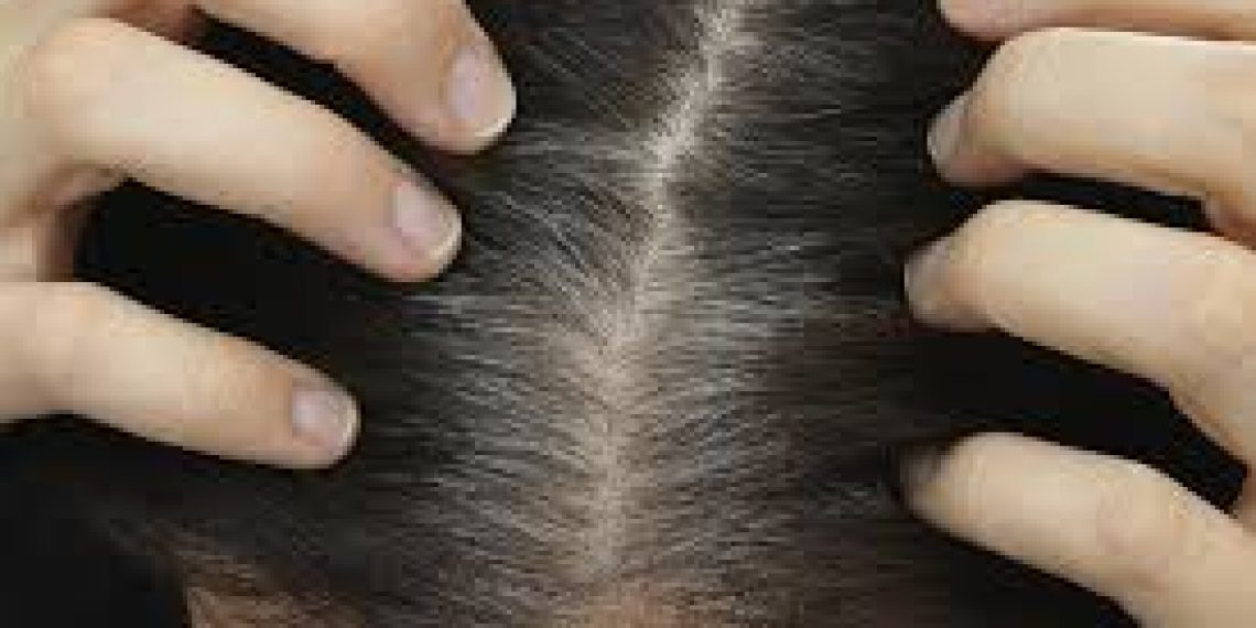 Warum fallen die Haare aus? Ursachen und Methoden gegen Haarausfall